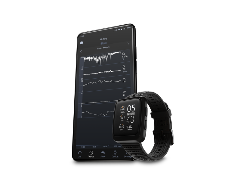 Masimo W1™, , dynamic